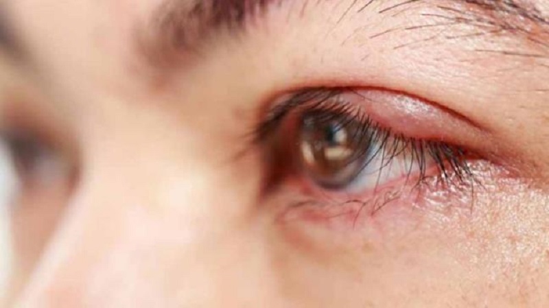 Làm gì khi hóa chất bắn vào mắt: Hé lộ quy trình 4 bước sơ cứu đáng kinh ngạc